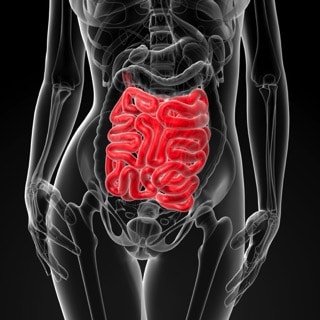 10 things that cause leaky gut copy