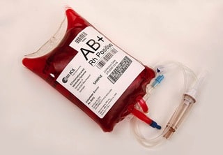 hemochromatosis copy