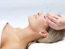 Now Booking Acupuncture Appointments!