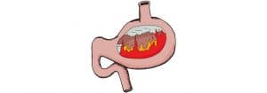 How to Support Optimal Stomach Acid for Good Digestion