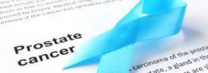 Prostate Cancer Testing For Optimal Health
