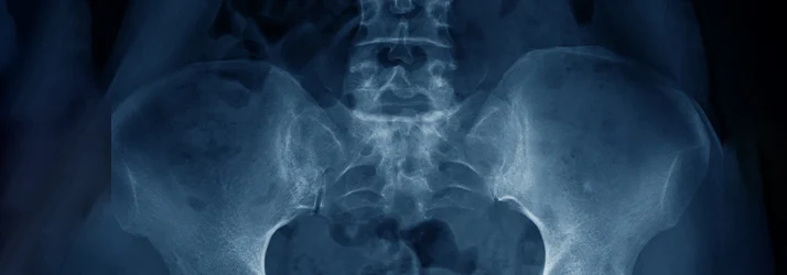 A New Non-Invasive Option for Pelvic Floor Weakness and Bladder Leakage in Cornelius NC